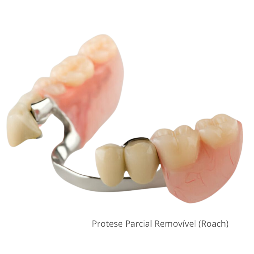 Prótese antiga com problemas